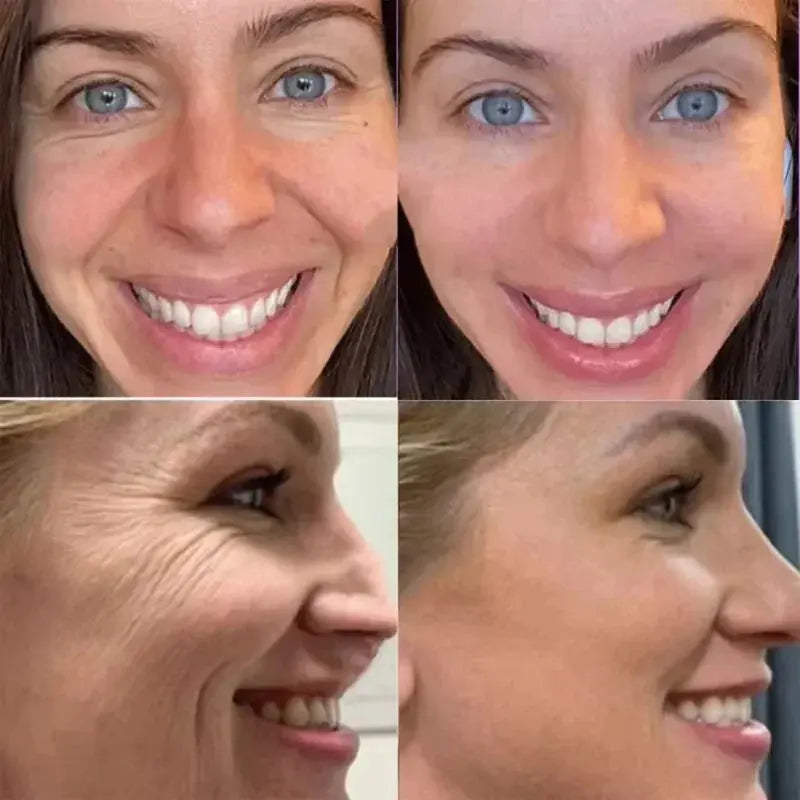 Glow Agelessly: Collagen & Hyaluronic Acid Eye Cream for Wrinkles – Korean Multi-Balm Stick - Shopulia