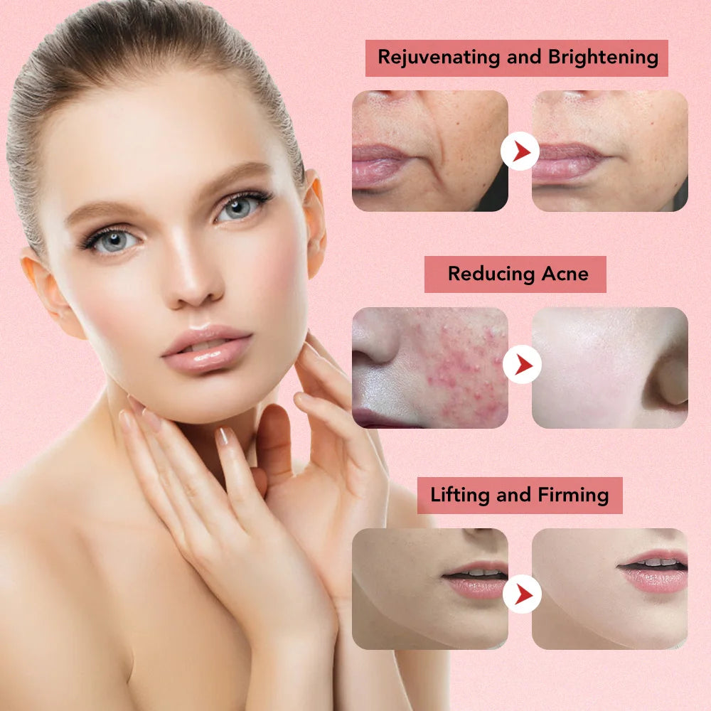 7-in-1 RF EMS Facial Massager – Anti-Aging, Skin Tightening & Light Therapy Wand