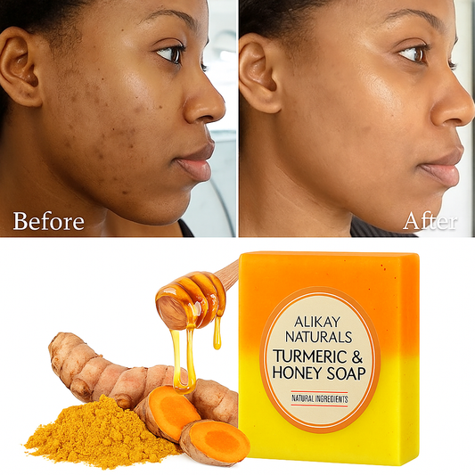 Honey Turmeric Soap – Natural Cleanser for Radiant, Even-Toned Skin