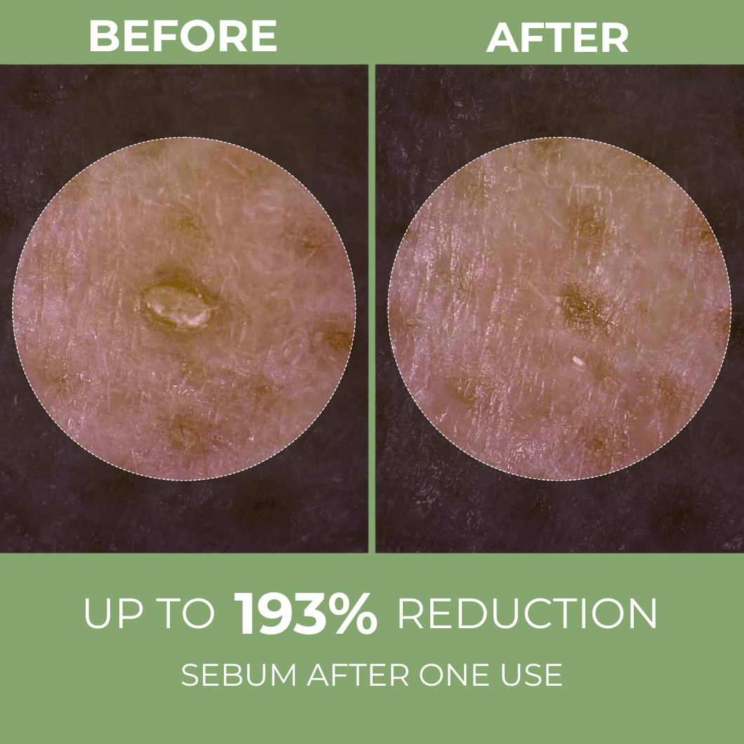 Rice Shot Ampoule Last Minute Offer Olivine Beauty