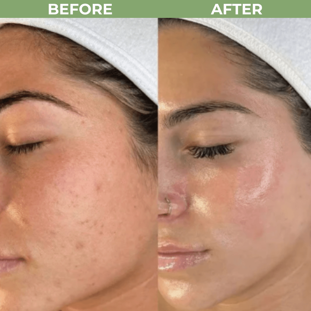 Rice Shot Ampoule Last Minute Offer Olivine Beauty