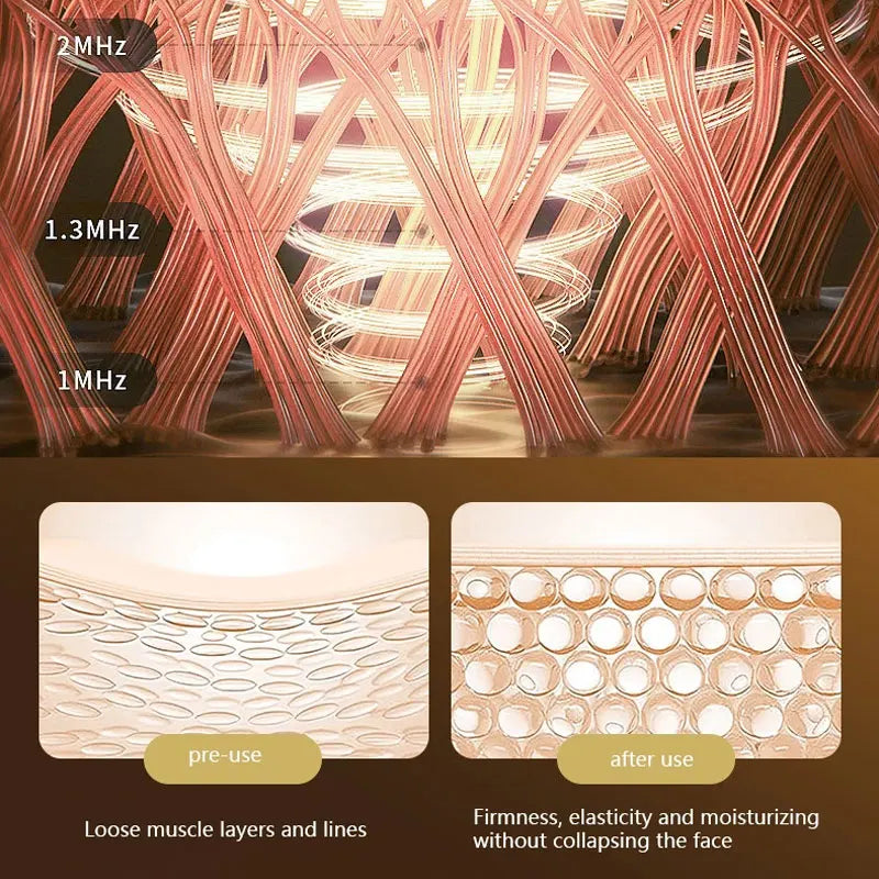 FaceLuxe™ Anti-Wrinkle Lift Device Shopulia