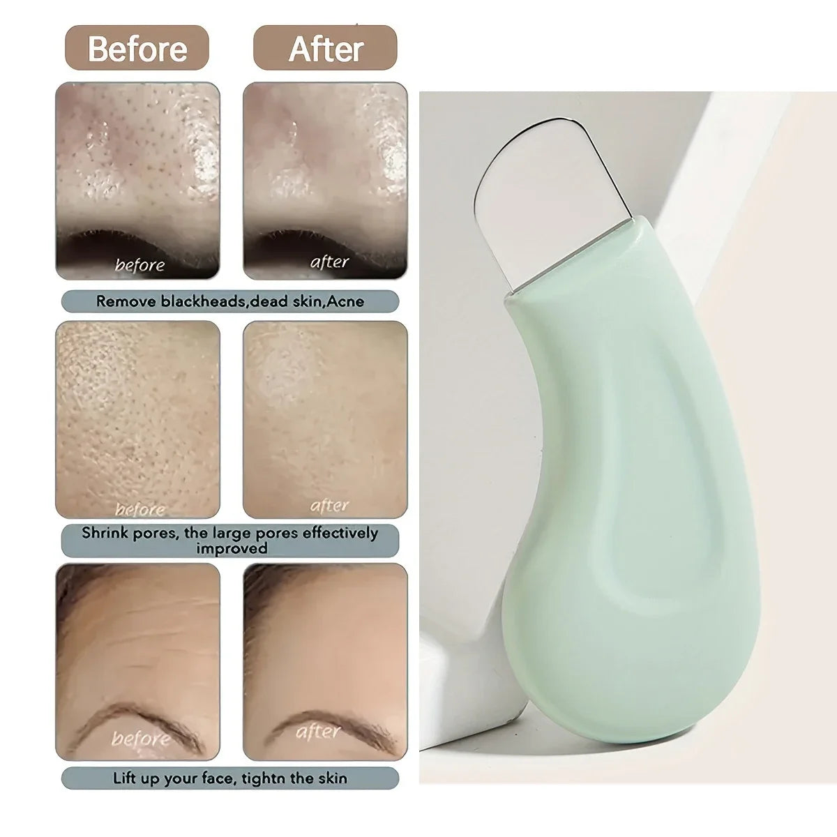 ClearSkin™ Nose & Face Pore Tool Shopulia