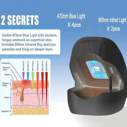 NailCure™ Fungal Laser Device Shopulia