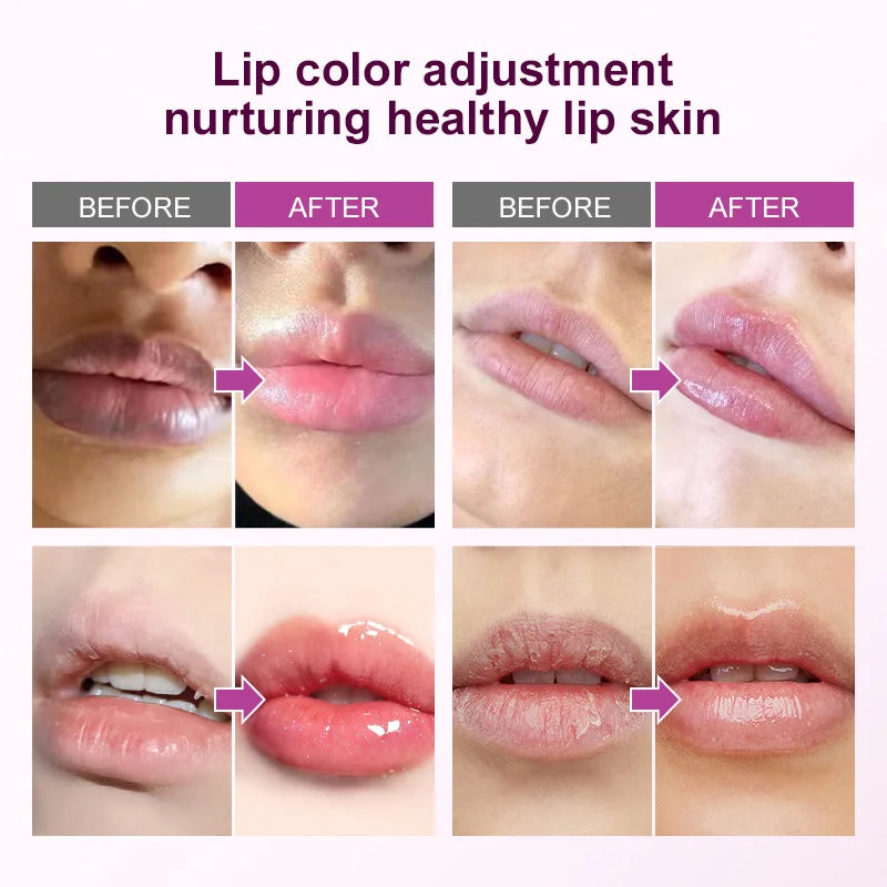 Lip Brightening & Moisturizing Balm – Restore Soft, Rosy Lips Naturally