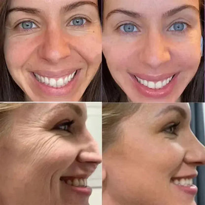 Glow Agelessly: Collagen & Hyaluronic Acid Eye Cream for Wrinkles – Korean Multi-Balm Stick - Shopulia