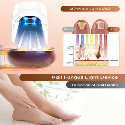 NailCure™ Fungal Laser Device Shopulia