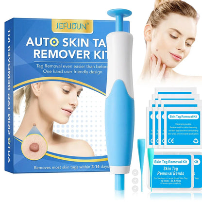 SkinPro™ Auto Skin Tag & Wart Removal Kit Shopulia