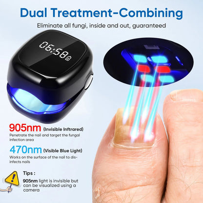NailCure™ Fungal Laser Device Shopulia