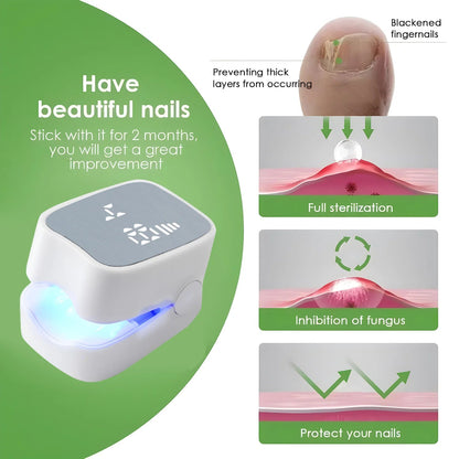 NailCure™ Fungal Laser Device Shopulia