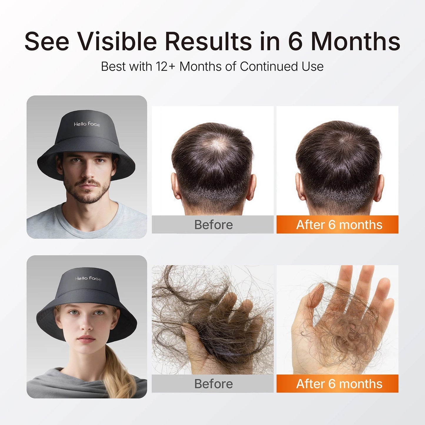 LED Hair Growth Bucket Hat – Red Light 336 LEDs Shopulia