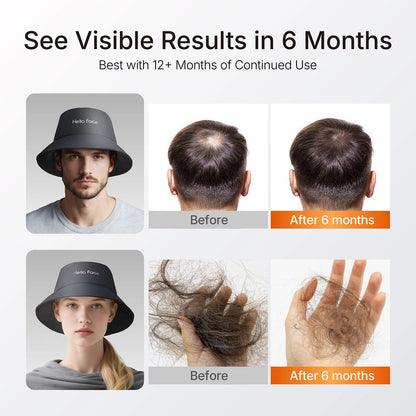 LED Hair Growth Bucket Hat – Red Light 336 LEDs Shopulia