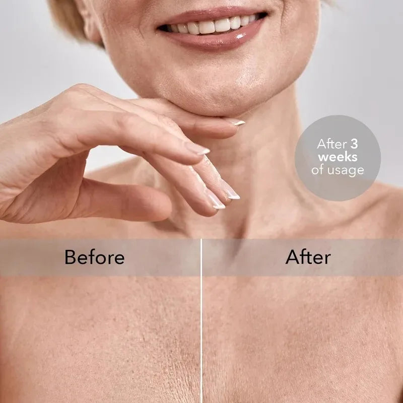 BustRenew™ Chest Wrinkle Prevention Pads Shopulia