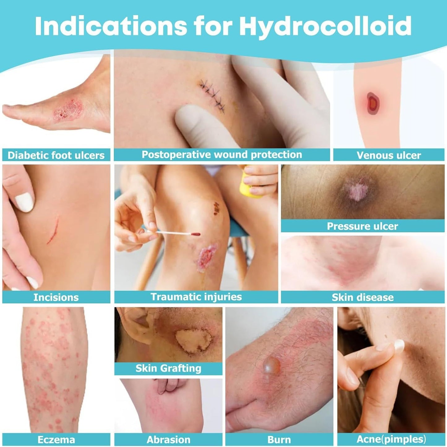 Hydrocolloid Wound Care Self-Adhesive Bandage